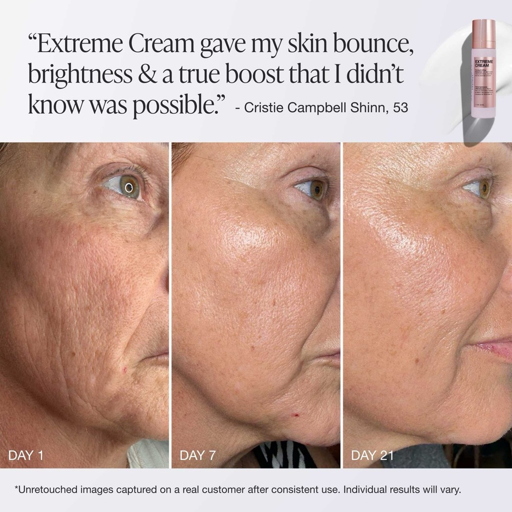 Buy Now Price- InnBeauty Project Extreme Cream - Picture 3 of 7